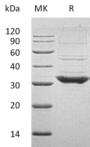 Recombinant Human TOLLIP (C-6His)