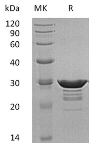 Recombinant Human Desmin (N-6His)