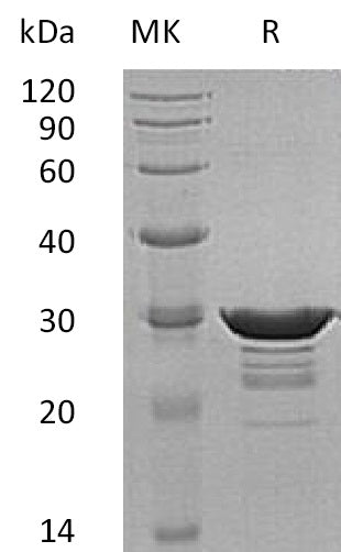Recombinant Human Desmin (N-6His)
