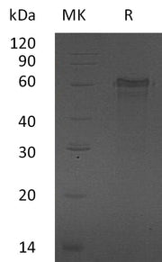 Recombinant Human ZNF70 (N-6His)