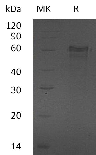 Recombinant Human ZNF70 (N-6His)
