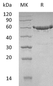 Recombinant Human KPNA2 (N-6His)
