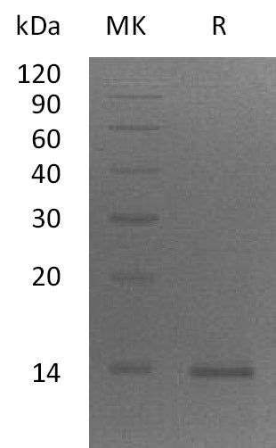 Recombinant Human ZBED1 (C-6His)