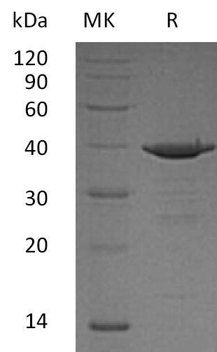Recombinant Human DAO (N-6His)