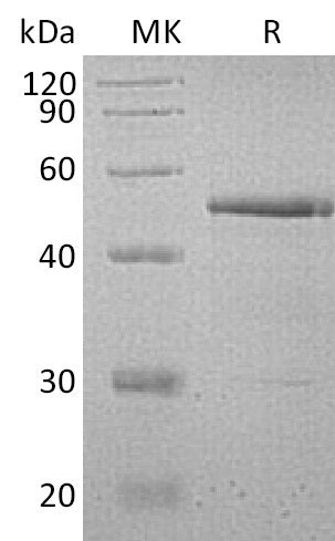 Recombinant Human Testin (C-6His)
