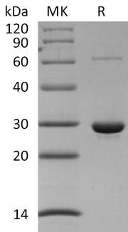 Recombinant Human PRDX4 (N-6His)