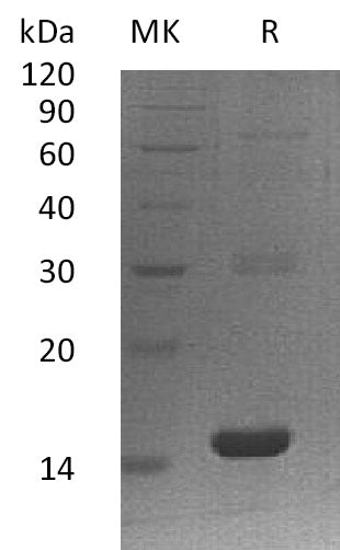 Recombinant Human PLA2G16 (N-6His)