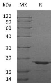 Recombinant Human LGALSL (C-6His)