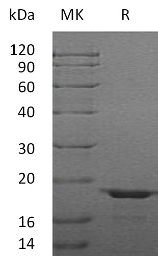 Recombinant Human LGALSL (C-6His)