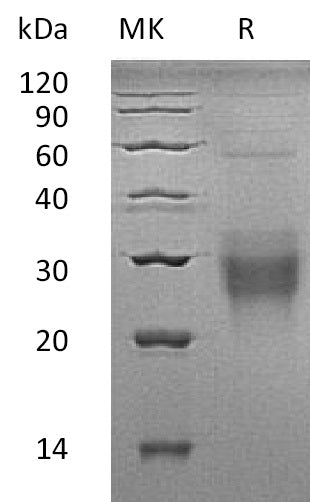 Recombinant Human NFYA (N-GST)