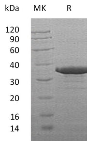 Recombinant Human SULT2B1 (C-6His)
