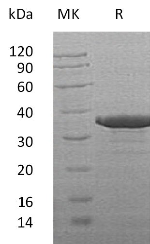 Recombinant Human SULT2B1 (C-6His)