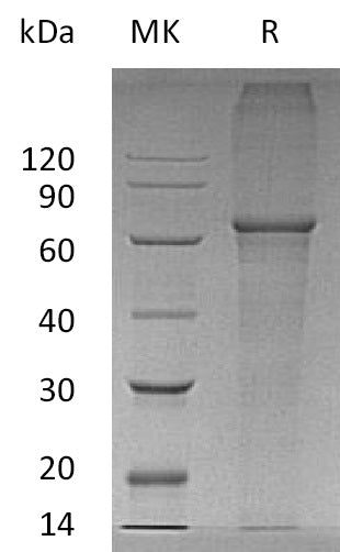 Recombinant Human XPNPEP3 (N, C-6His)