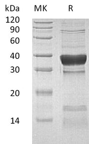 Recombinant Human PPP1CC (N, C-6His)