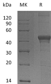 Recombinant Human DFF45 (N-6His)
