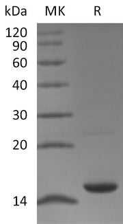 Recombinant Human MAP1LC3A (C-6His)