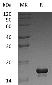 Recombinant Human CST3 (N-6His)