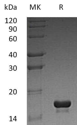 Recombinant Human CST3 (N-6His)