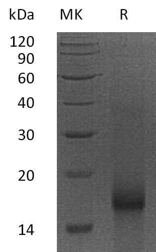 Recombinant Human BIRC5