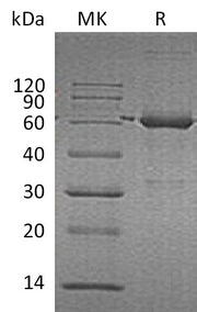 Recombinant Human CAT