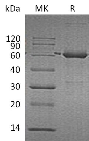 Recombinant Human CAT