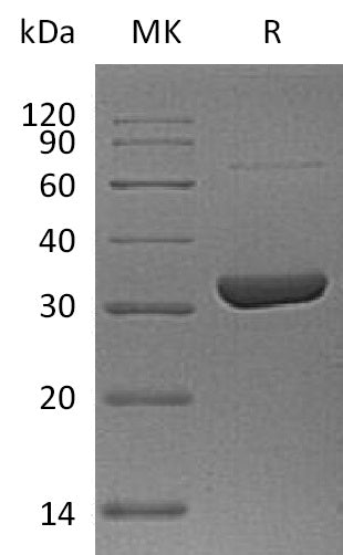 Recombinant Human ANXA10