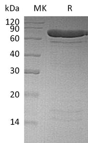 Recombinant Human PADI4 (N-6His)
