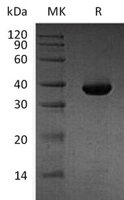 Recombinant Human MetAP1D (N, C-6His)