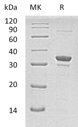 Recombinant Human SULT1A2 (N-6His)