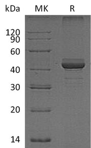 Recombinant Human FIBP