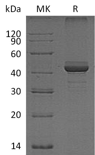 Recombinant Human FIBP