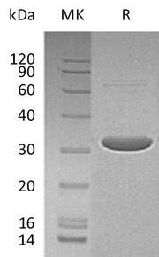 Recombinant Human DCK (N-6His-T7)