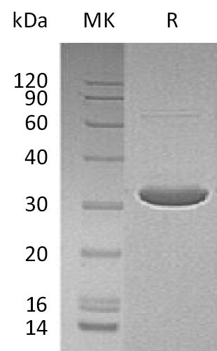Recombinant Human DCK (N-6His-T7)