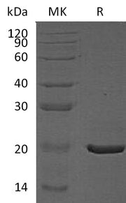 Recombinant Human CRYAA (C-6His)