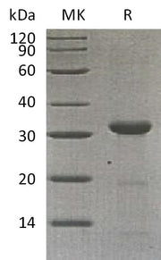 Recombinant Human Carbonic Anhydrase 10 (C-6His)
