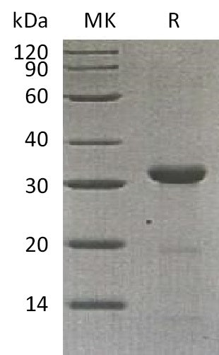 Recombinant Human Carbonic Anhydrase 10 (C-6His)