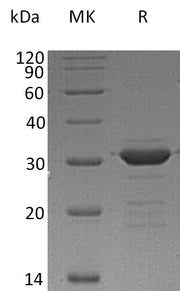 Recombinant Human CD72 (N-Trx-6His)