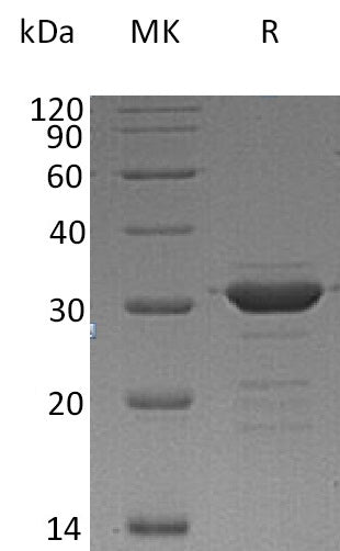 Recombinant Human CD72 (N-Trx-6His)