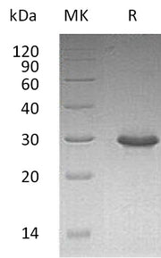 Recombinant Human TRIM (C-6His)
