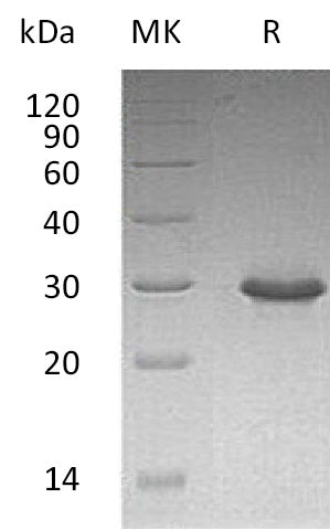 Recombinant Human TRIM (C-6His)