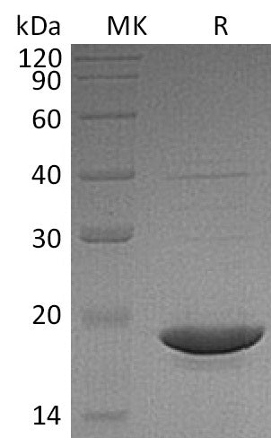 Recombinant Human dUTPase