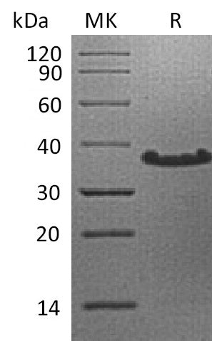 Recombinant Human CTCF
