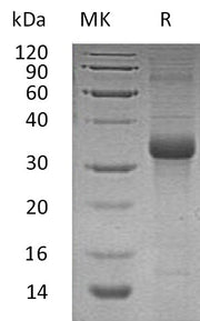 Recombinant Human FSTL1