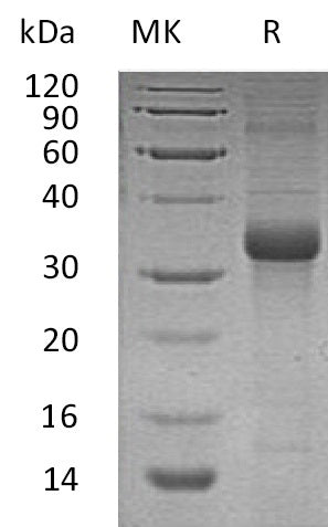 Recombinant Human FSTL1