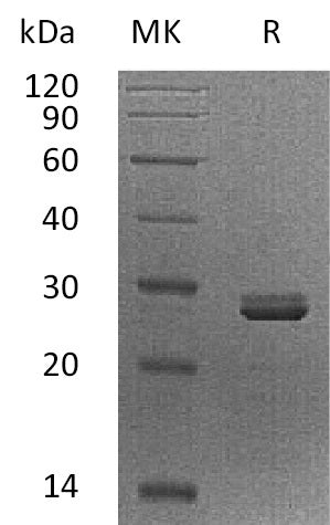 Recombinant Human PDCD10