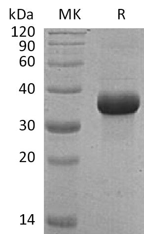 Recombinant Human FSTL1 (C-6His)
