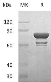 Recombinant Human STAT1