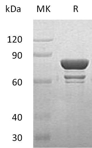 Recombinant Human STAT1