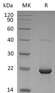 Recombinant Human dUTPase (N-6His)