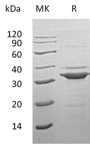 Recombinant Human TPM3